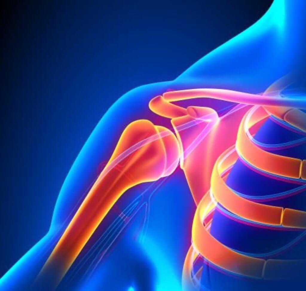 Shoulder Pain