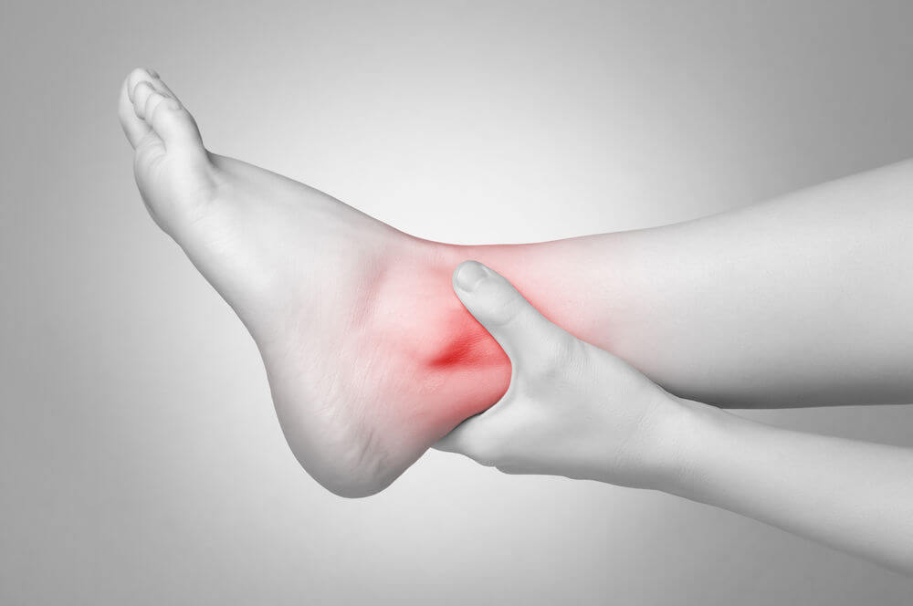 Treatment for an Ankle Sprain
