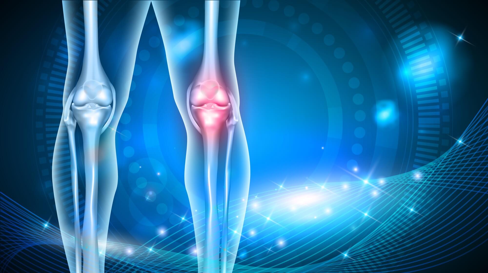 Knee Pain Relief Without Drugs or Surgery
