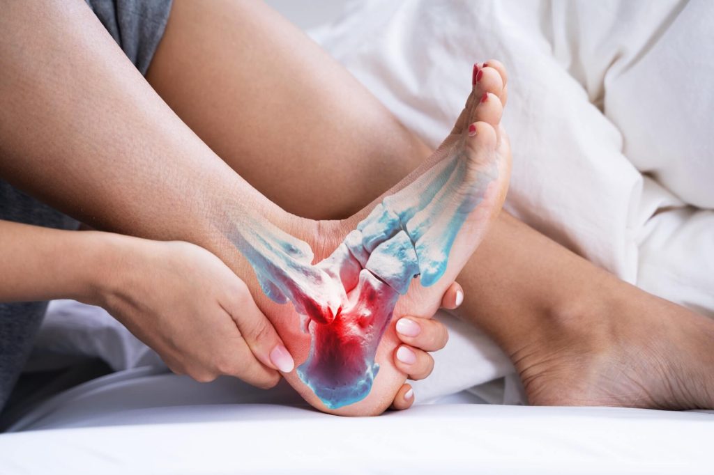 Woman Feeling Achilles Heel Pain In Bed