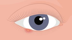atlantic eye carephoto.jpg